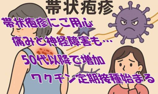 帯状疱疹にご用心　痛みと神経障害も…50代以降で増加、ワクチン定期接種始まる