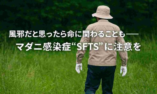 マダニ感染症“SFTS”に注意を。風邪だと思ったら命に関わることも
