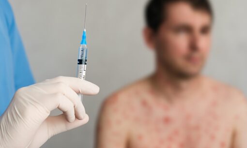 はしか感染拡大　福岡で新たに2人　東京では昨年の3倍に拡大