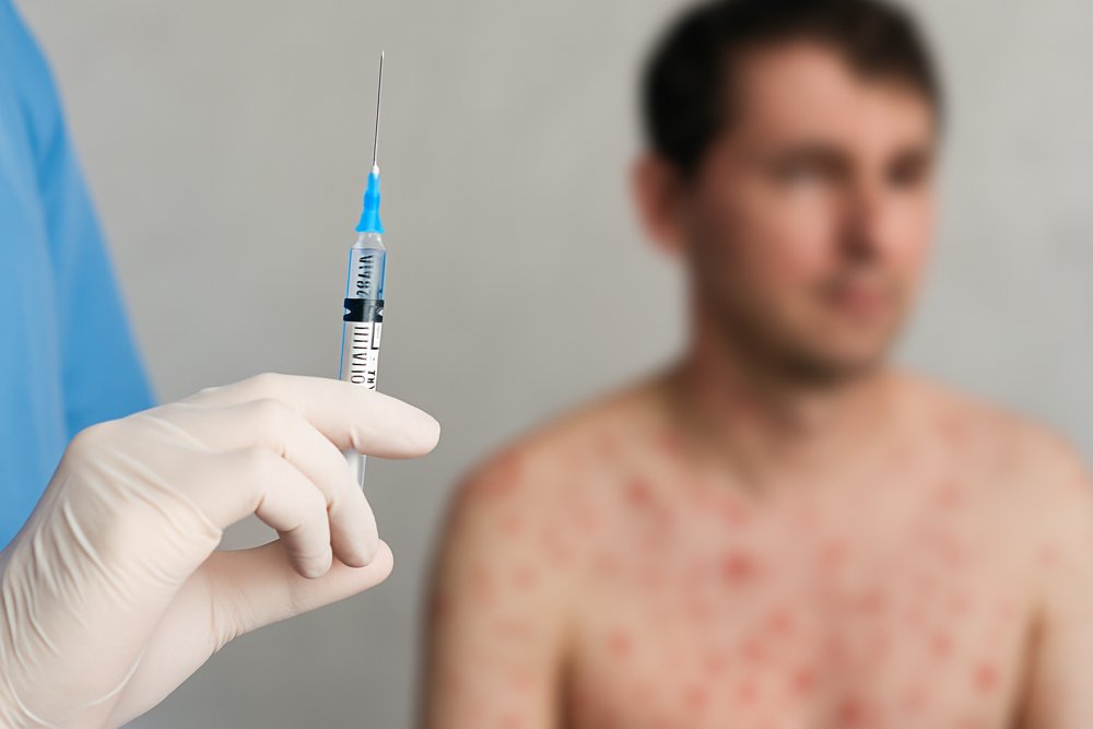 はしか イメージ