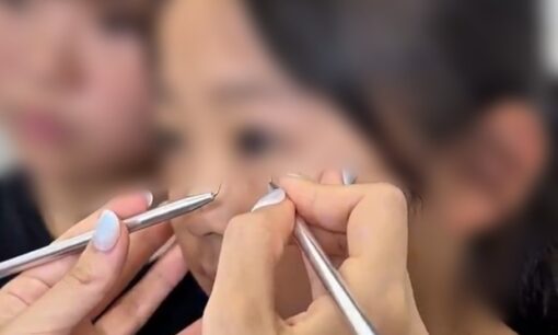 10歳小学生の二重整形動画に批判殺到　美容クリニックが直面する「倫理」と「説明責任」